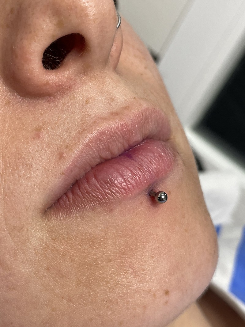 Piercing bucales 2022 07 08 12 49 31