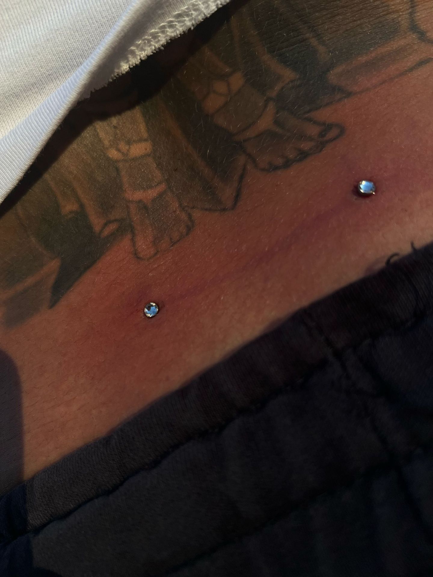 Piercing surface microdermal 2024 09 24 20 56 29