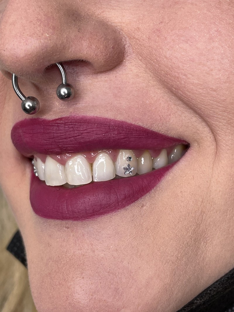 Toothgems 2022 04 04 13 21 36