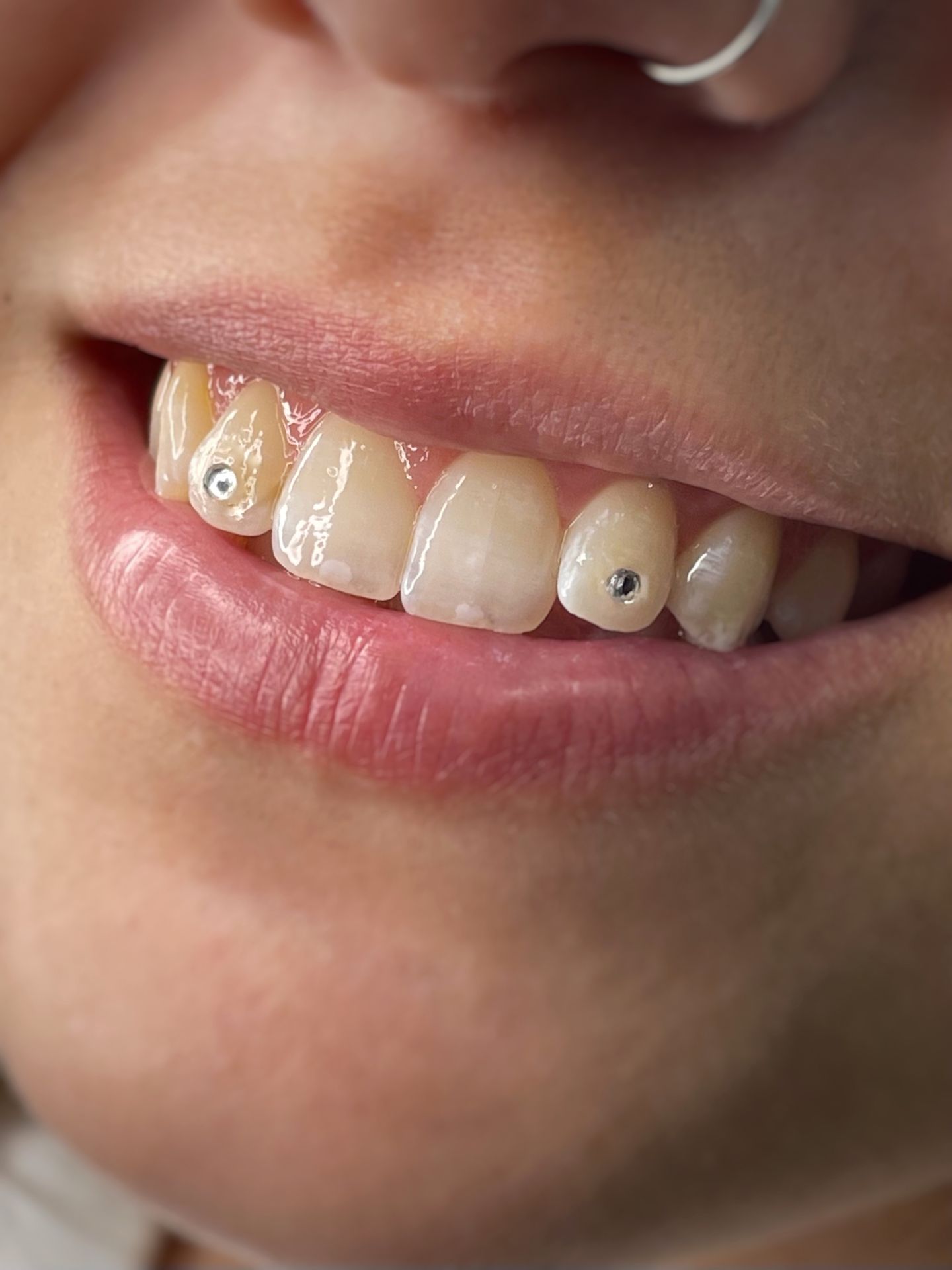 Toothgems 2022 05 19 14 01 30