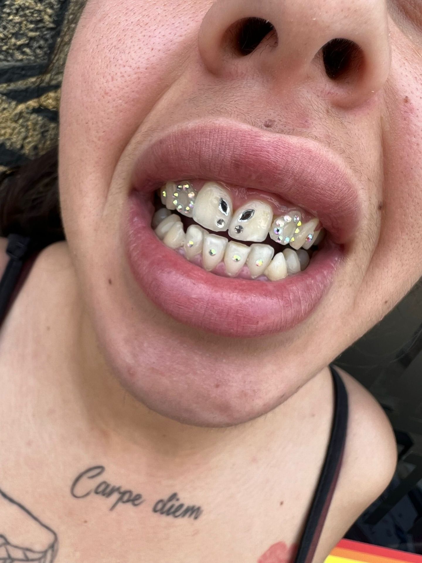 Toothgems 2024 01 19 17 58 02