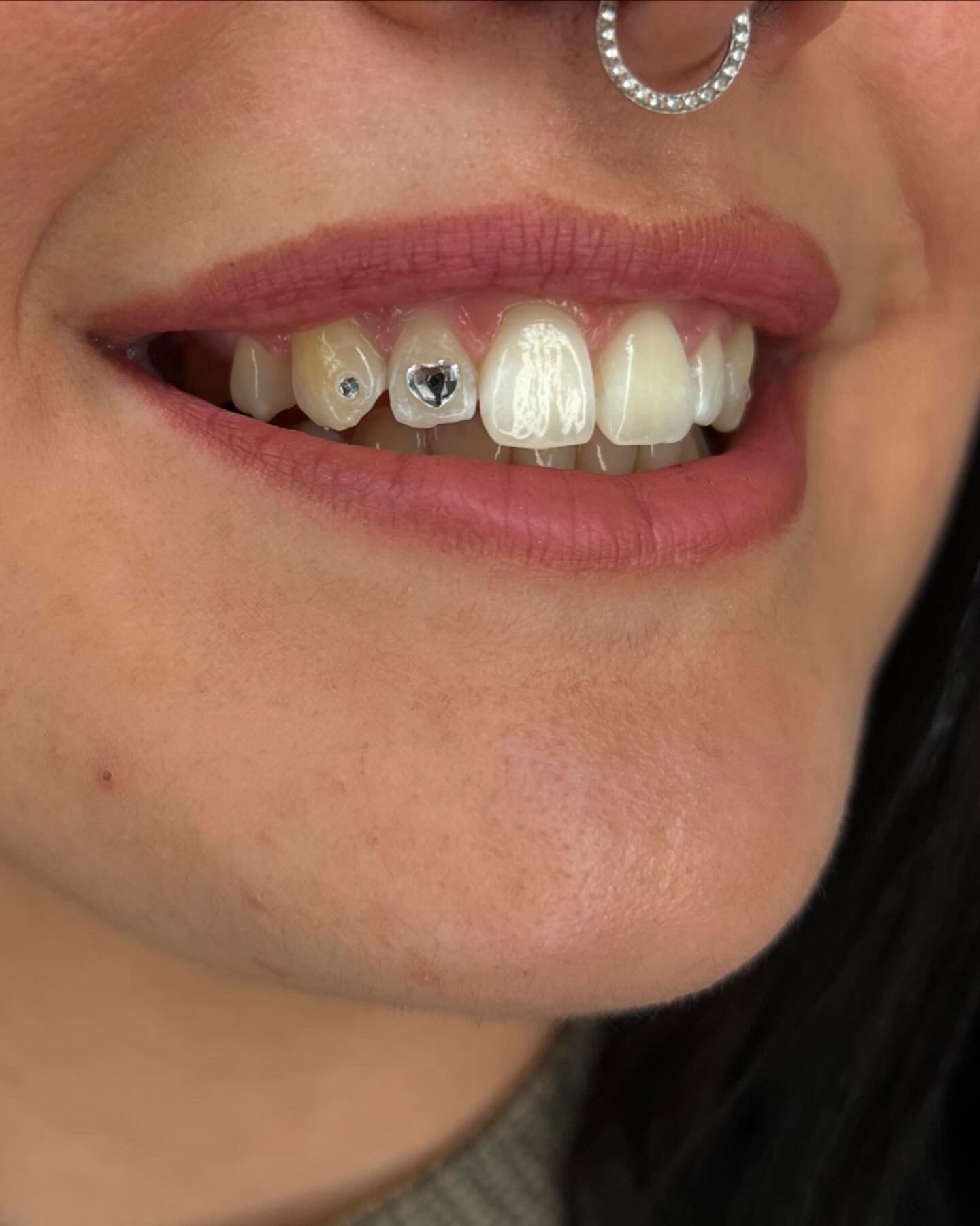 Toothgems 2024 05 02 17 25 04