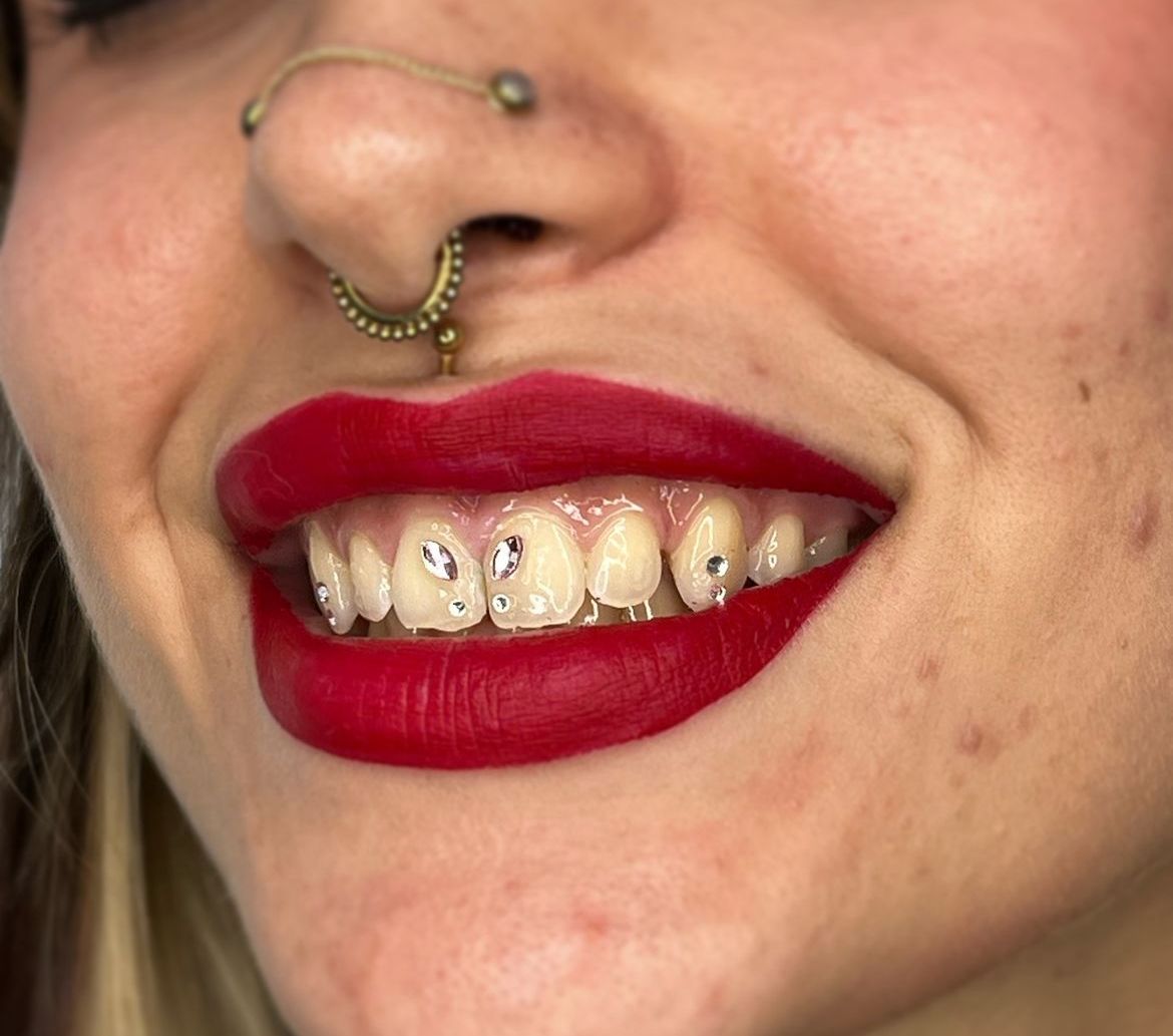 Toothgems 2024 05 02 17 35 53
