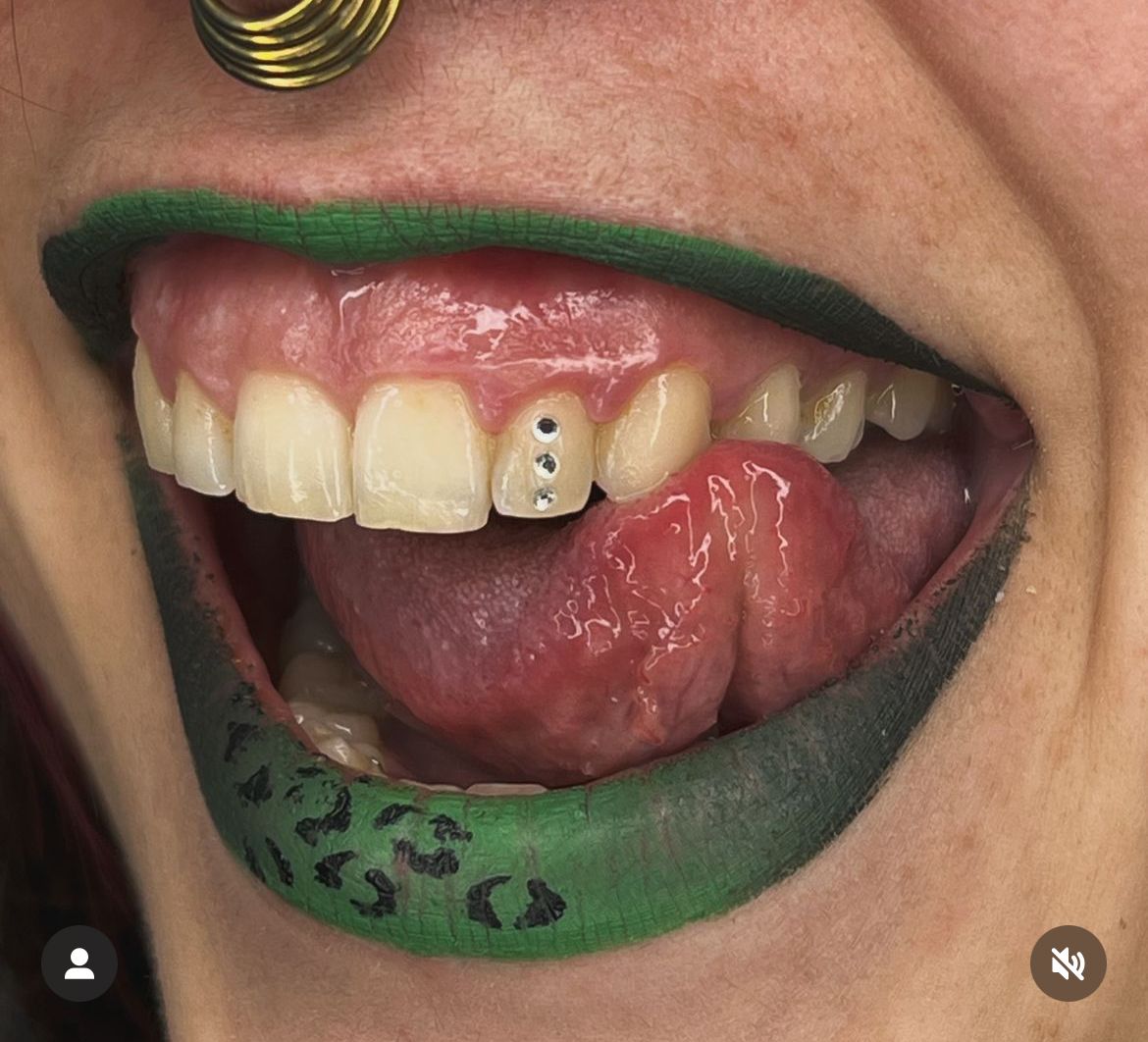 Toothgems 2024 05 02 17 36 08