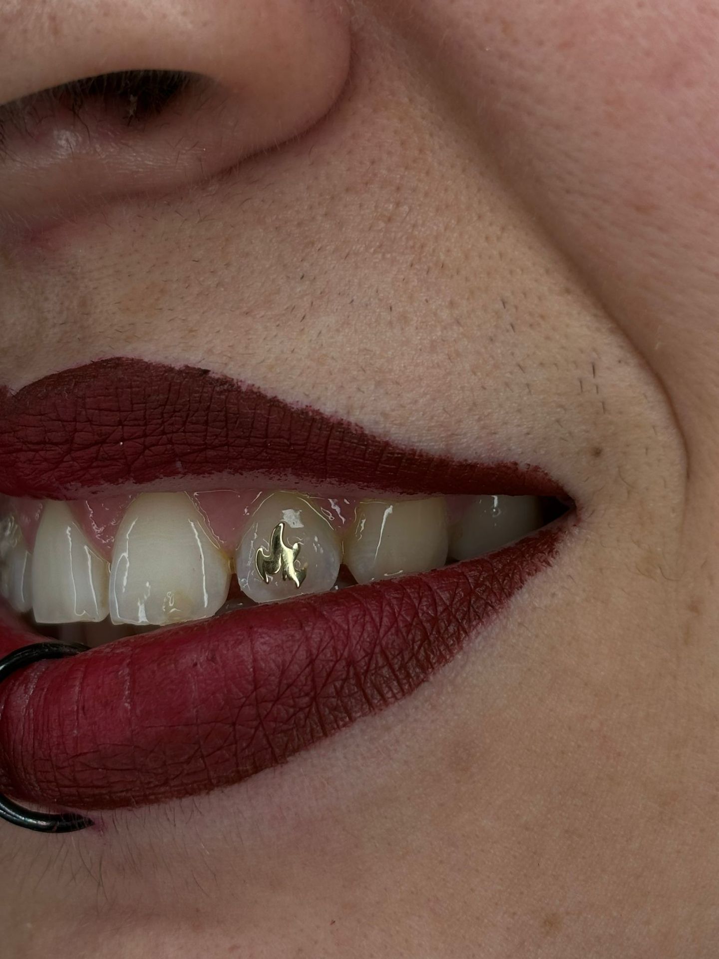 Toothgems 2024 05 02 17 39 50