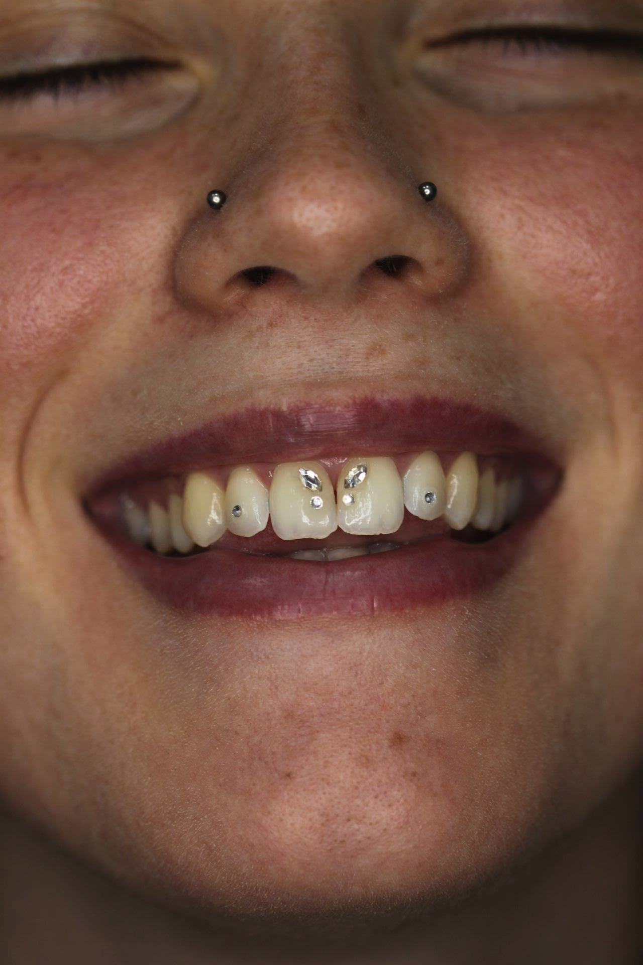 Toothgems 2024 08 01 19 56 24