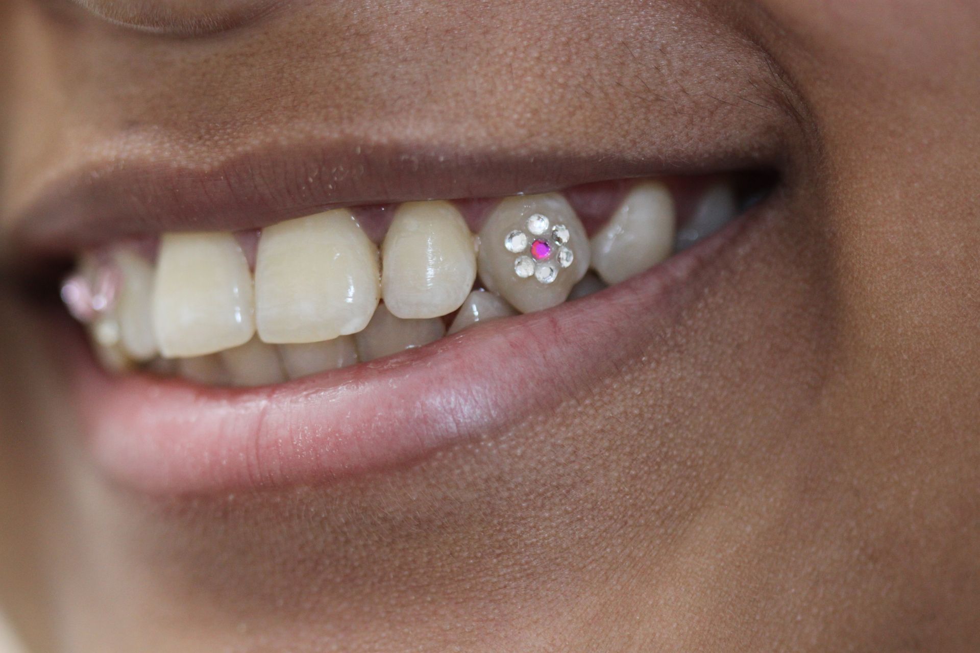 Toothgems 2024 08 27 18 31 38