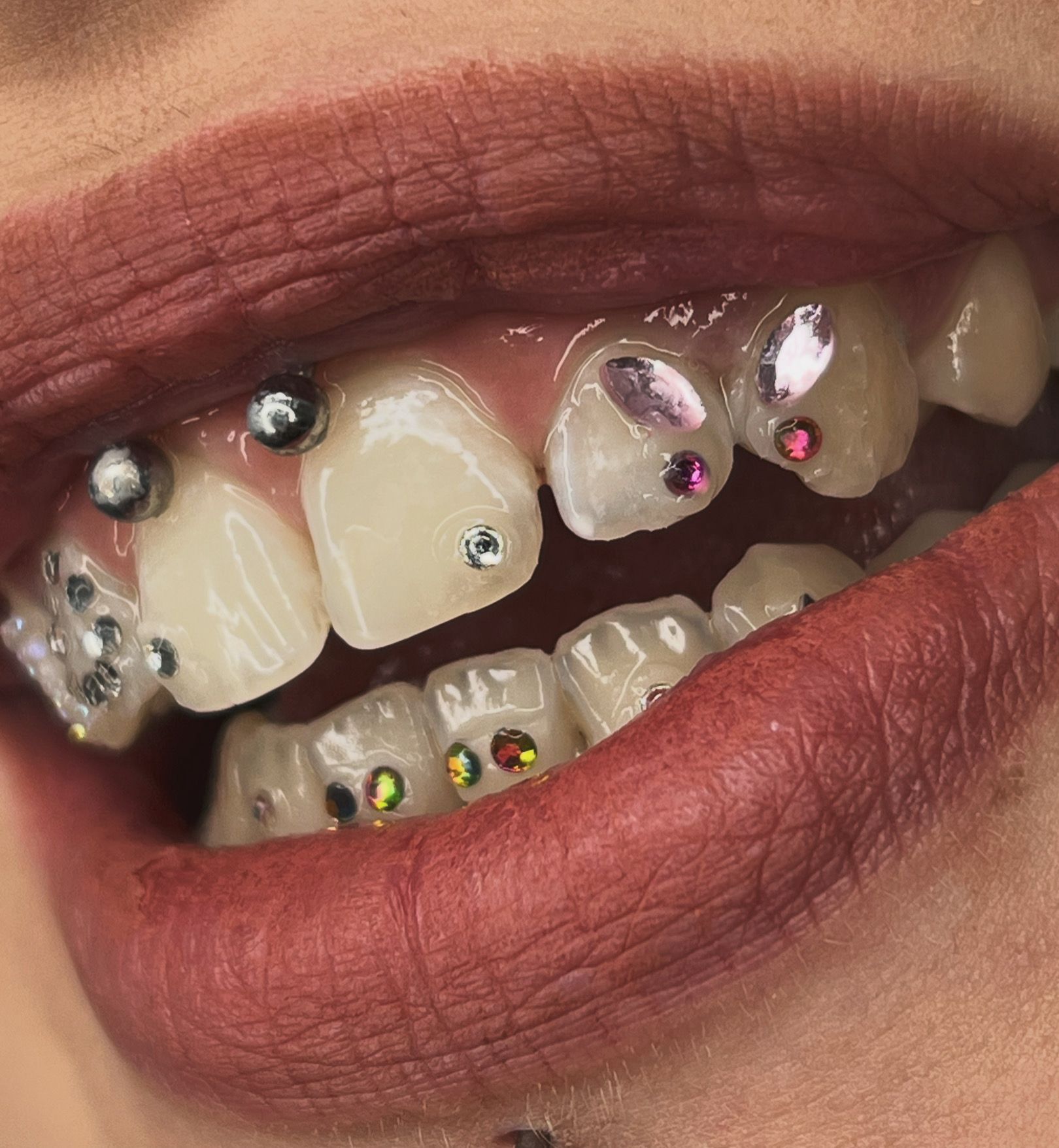 Toothgems 2024 09 24 20 56 29