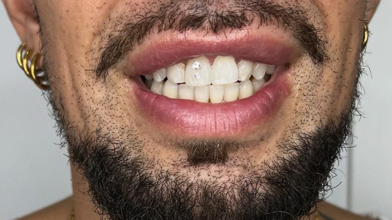 Toothgems 2024 09 24 23 22 56