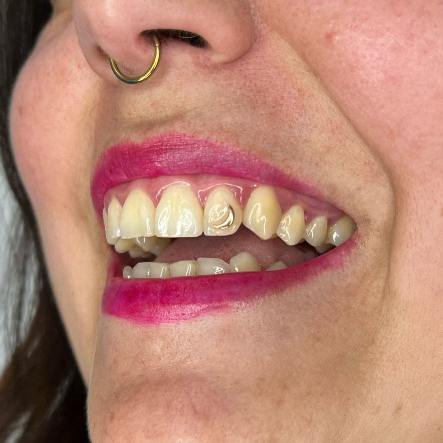 Toothgems 2024 09 24 23 25 01