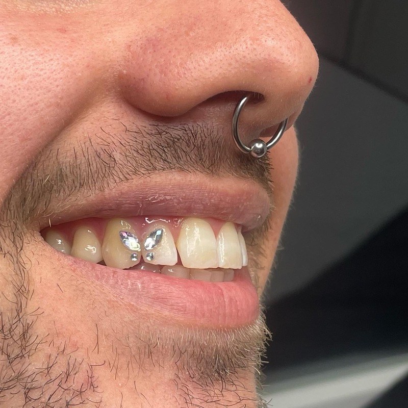 Toothgems 2024 09 25 02 00 46